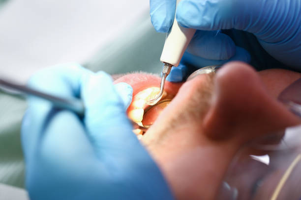 Best Knocked-Out Tooth Emergency  in Millersburg, OH
